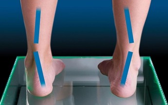 Visual representation of supination: highlighting the foot's tendency to roll outward, with an explanation of how this motion can impact ankle stability and contribute to related injuries