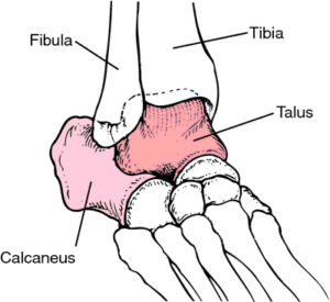 chronic ankle instability causes and symptoms