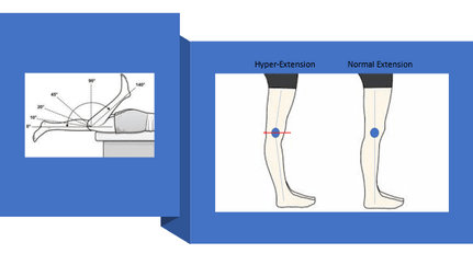 recovery treatment for knee hyperextension
